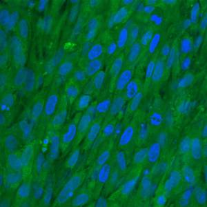 60-x-0-2-cm-col-gag-750k-seeded-15_